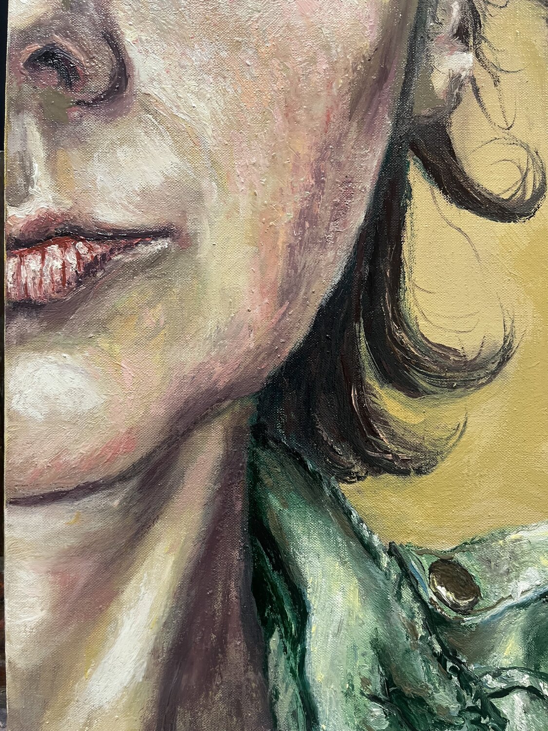 Surface du système nerveux